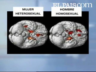 cerebro homosexual
